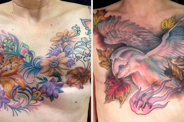 ΑΥΤΑ τα τατουάζ νικούν τον καρκίνο