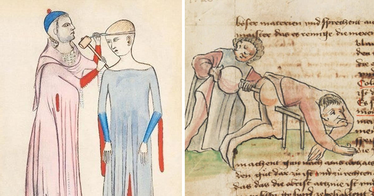 10 απίθανες ηλιθιότητες που ήταν καθημερινότητα στο Μεσαίωνα